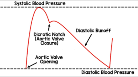 Arterial pressure waveform showing steep systolic upstroke, systolic peak, decline, dicrotic notch marking aortic valve closure, diastolic runoff, and end-diastolic pressure at the trough