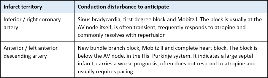 Infarct territory