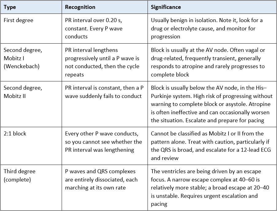 description of heart blocks